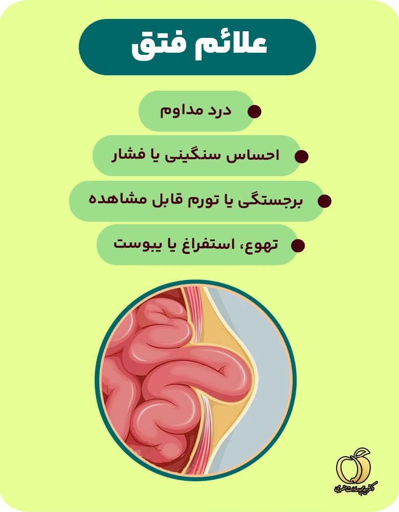 علائم فتق