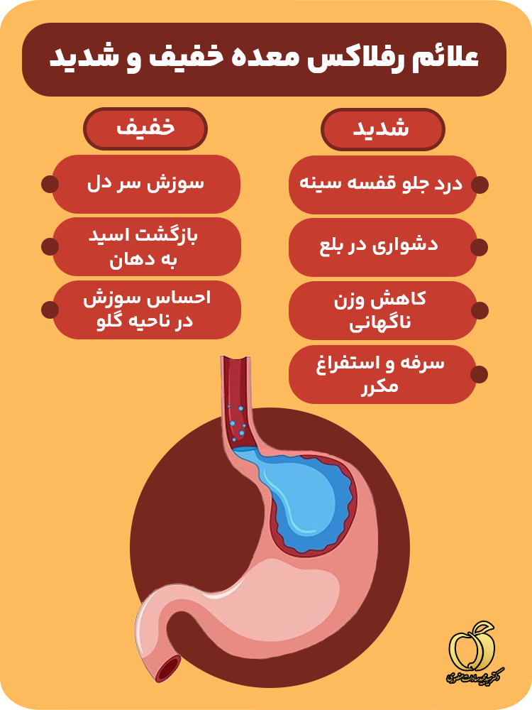 علائم رفلاکس معده