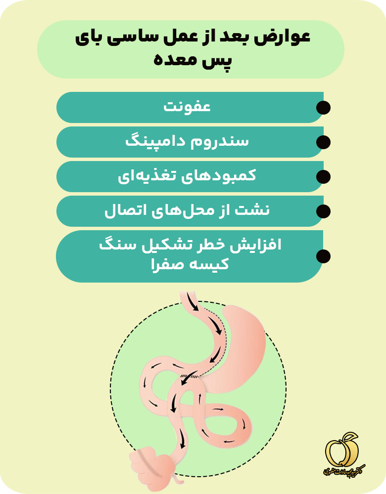 عوارض بعد از عمل ساسی بای پس معده