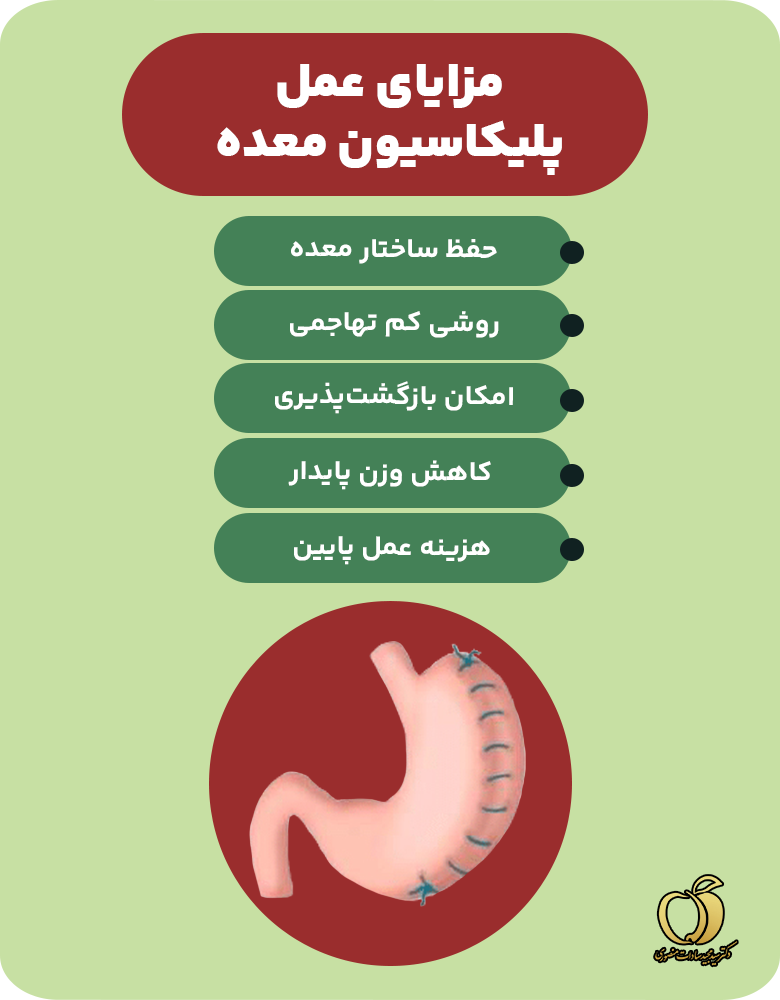 مزایای عمل پلیکاسیون معده (اینفوگرافیک)