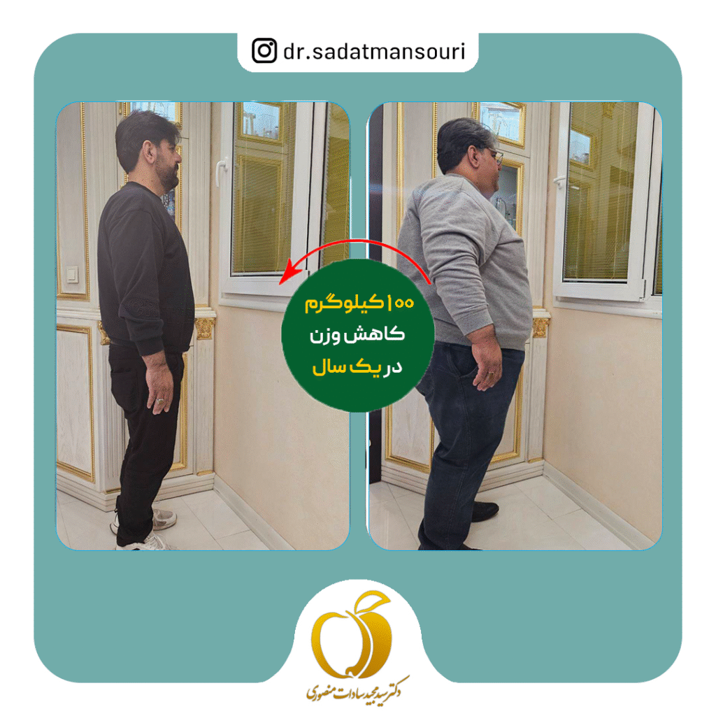 کاهش ۱۰۰ کیلوگرمی با جراحی لاغری