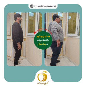 کاهش ۱۰۰ کیلوگرمی با جراحی لاغری