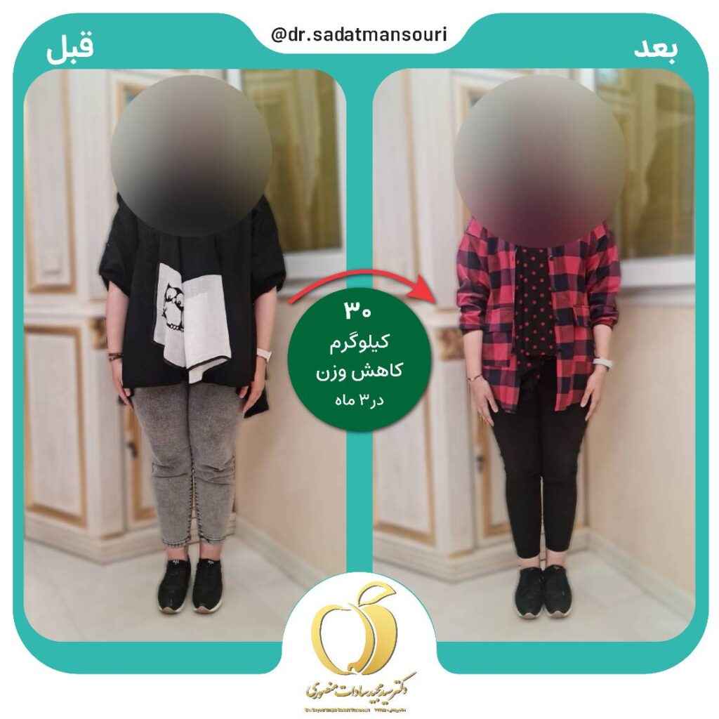 عمل لاغری و کاهش 30 کیلو وزن