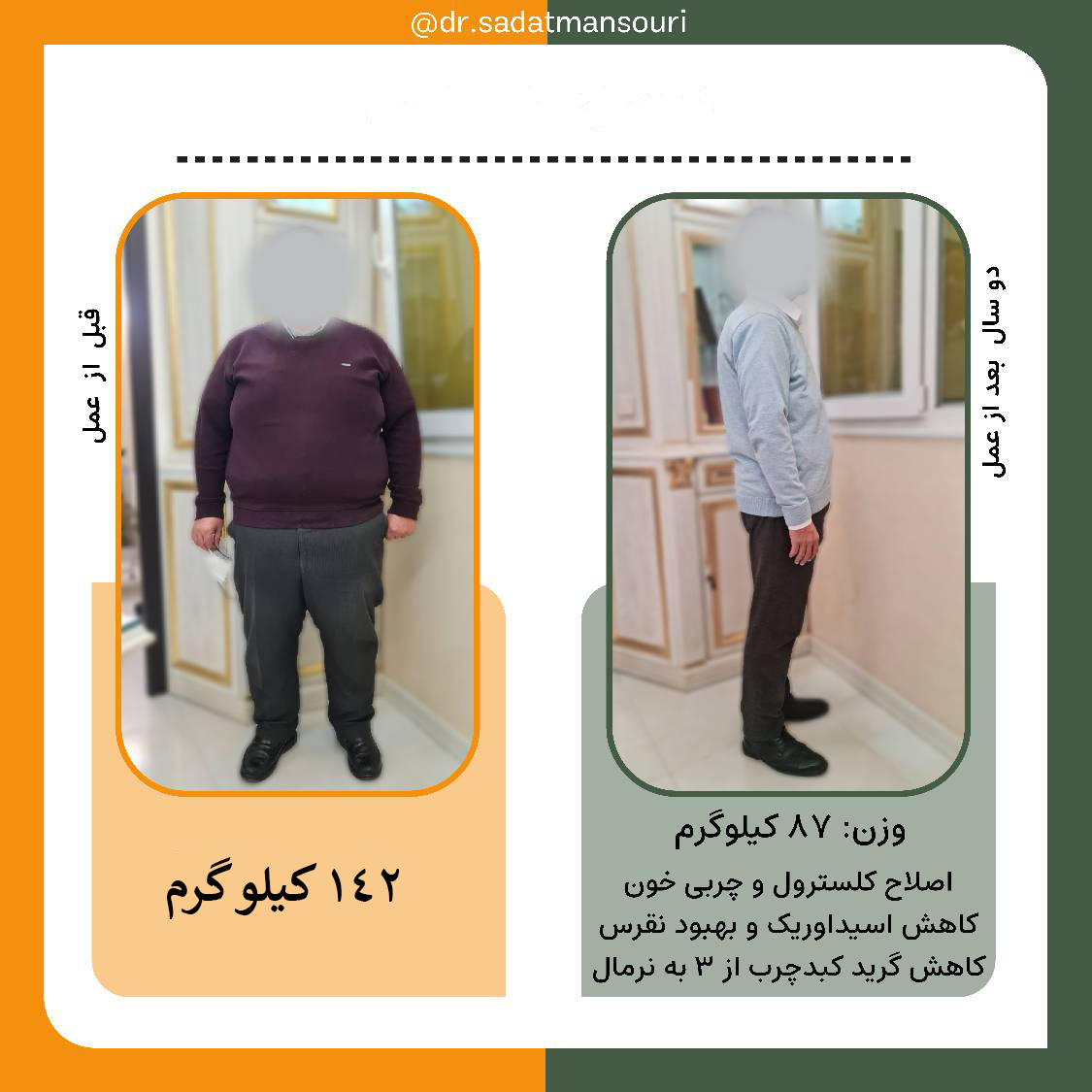 بازگشت اعتمادبه‌نفس پس از جراحی لاغری