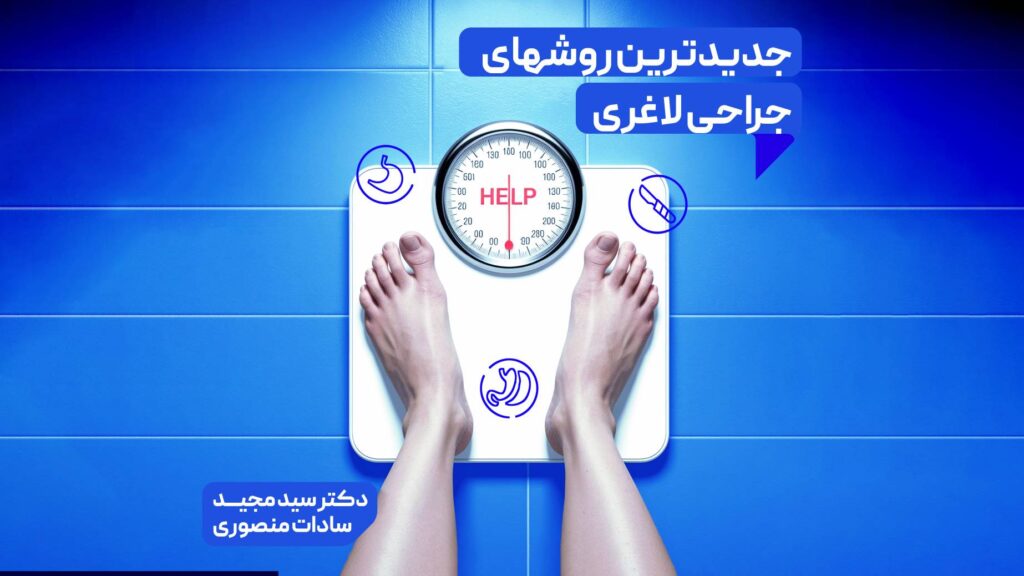 عمل های لاغری جدید