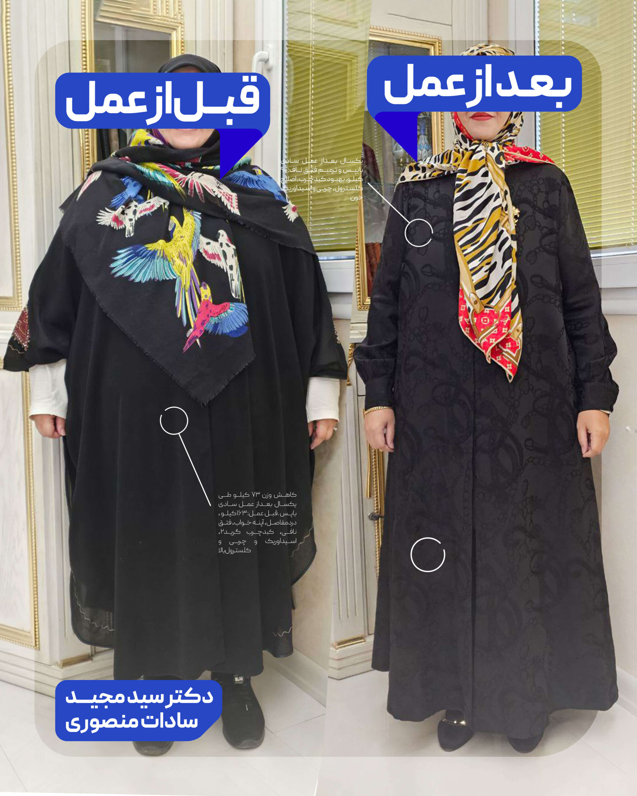 عمل جراحی چاقی