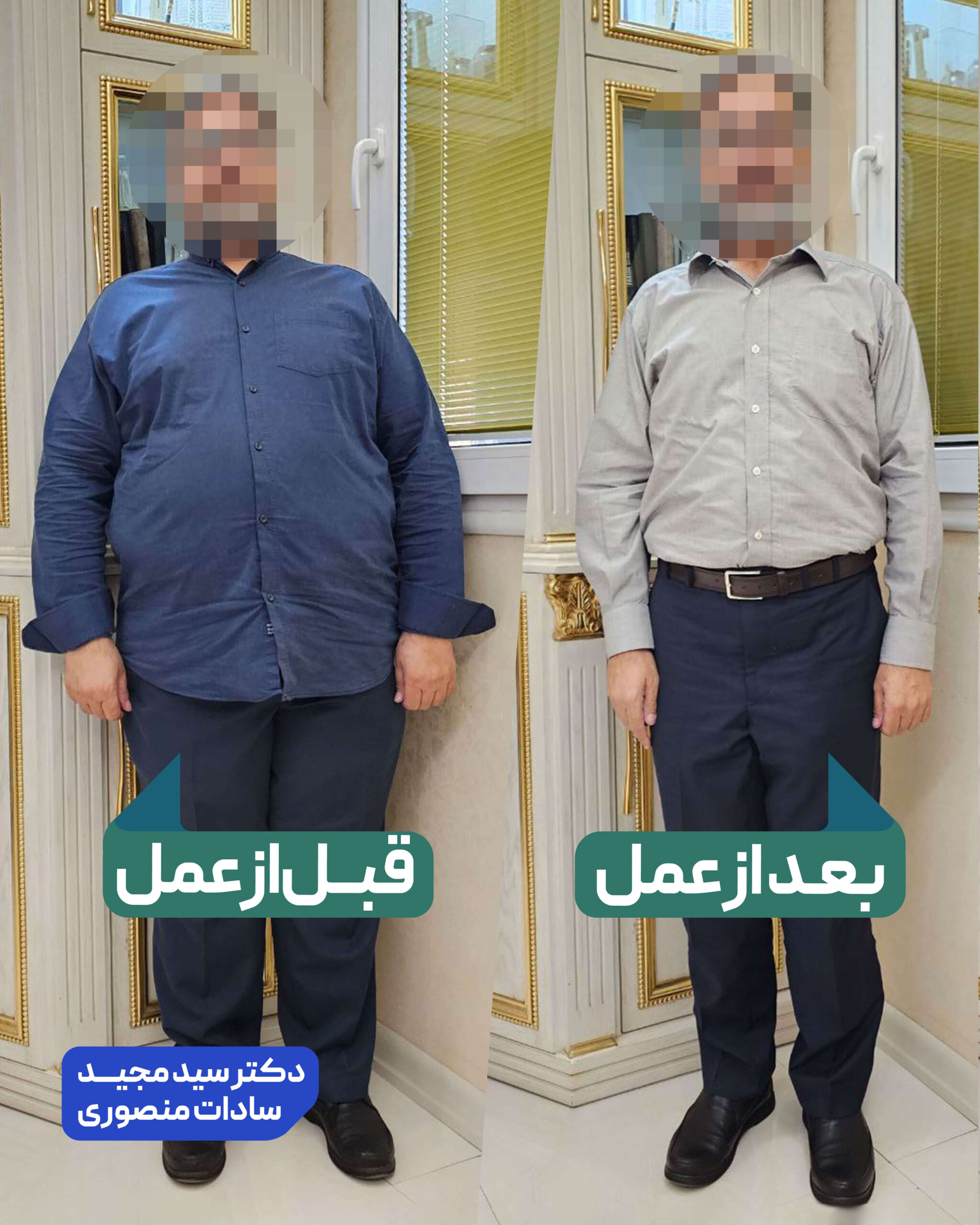 عمل جراحی چاقی