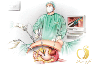بهترین جراح اسلیو معده