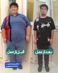 عمل لاغری پسر 13 ساله