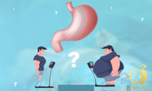 بهترین جراح اسلیو در تهران