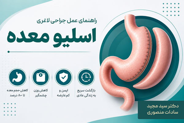 عمل جراحی لاغری اسلیو معده