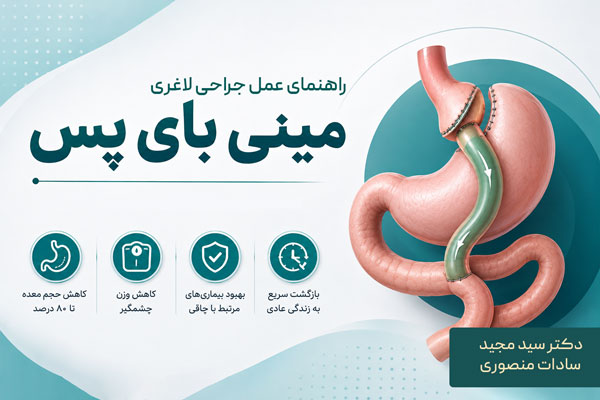 عمل جراحی لاغری مینی بای س