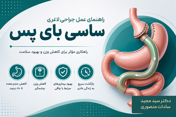 عمل جراحی لاغری ساسی بای پس