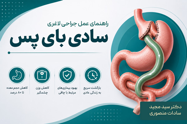 عمل جراحی لاغری سادی بای پس