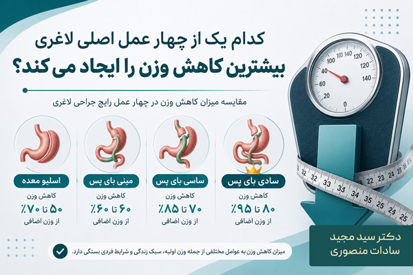 مقایسه کاهش وزن چهار عمل اصلی جراحی لاغری