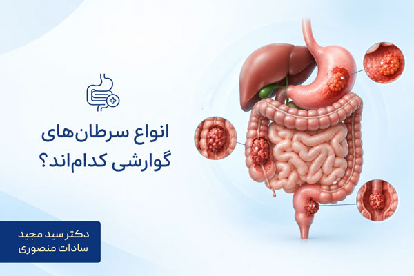 انواع سرطانهای گوارشی کداماند؟