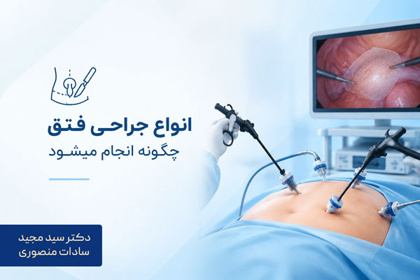 انواع جراحی فتق چگونه انجام میشود
