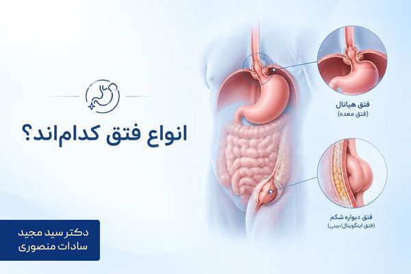انواع فتق کداماند؟