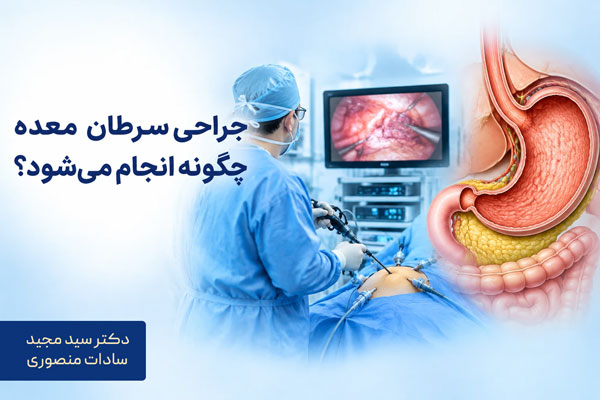 جراحی سرطان معده چگونه انجام میشود؟